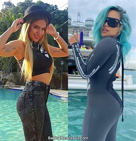 Karol G Plastic Surgery Comparison Photos